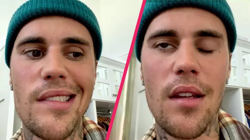 'Pray for him': Fans are devastated about Justin Bieber's facial paralysis 