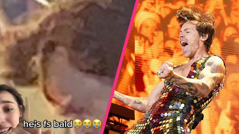  Is Harry Styles bald? This crazy fan theory reckons those luscious locks aren’t real