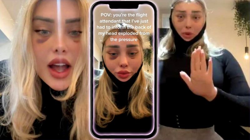 OnlyFans model explains how her 'head exploded' mid flight after cat eye surgery